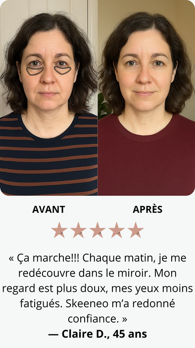 Résultats après 45 jours d'utilisation