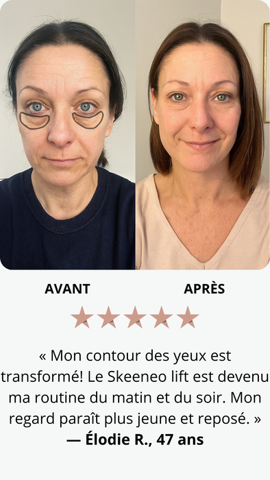 Résultats après 30 jours d'utilisation
